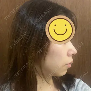 10日目の経過画像（2枚目）