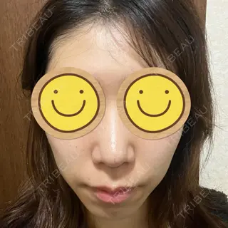 11日目の経過画像（1枚目）