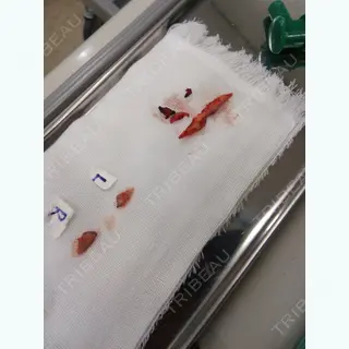 0日目の経過画像（2枚目）