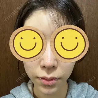 31日目の経過画像（1枚目）