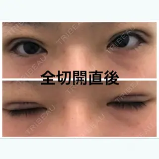 0日目の経過画像（1枚目）