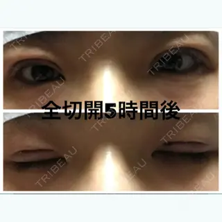 0日目の経過画像（2枚目）