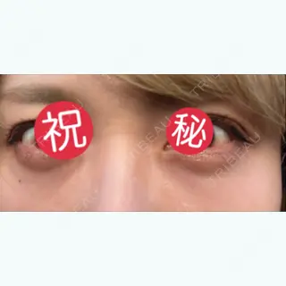 16日目の経過画像（1枚目）