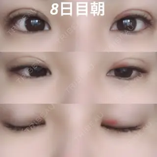 8日目の経過画像（1枚目）