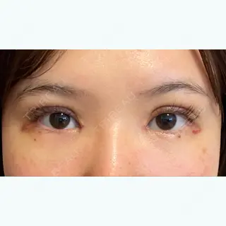 7日目の経過画像（1枚目）