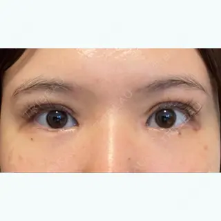 10日目の経過画像（1枚目）
