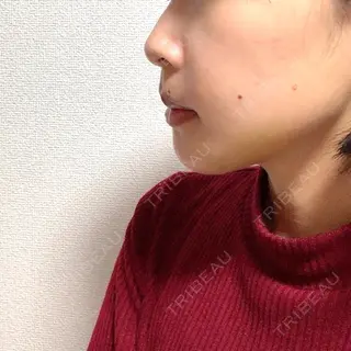 7日目の経過画像（2枚目）