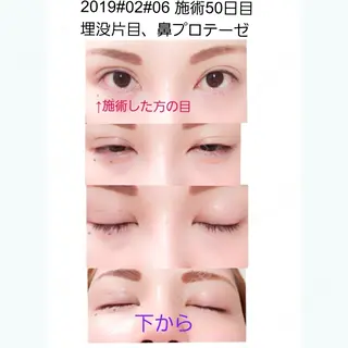 50日目の経過画像（1枚目）