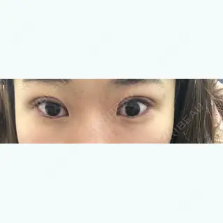 9日目の経過画像（1枚目）