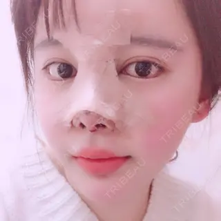 2日目の経過画像（1枚目）