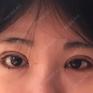 40日目の経過画像（1枚目）