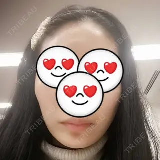 9日目の経過画像（1枚目）