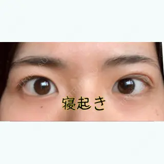 4日目の経過画像（1枚目）