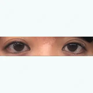 144日目の経過画像（1枚目）