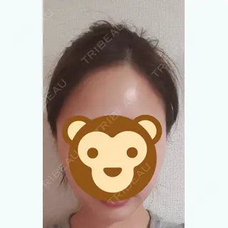 11日目の経過画像（1枚目）