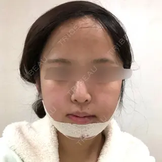 2日目の経過画像（1枚目）