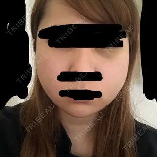 11日目の経過画像（1枚目）