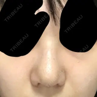 9日目の経過画像（1枚目）