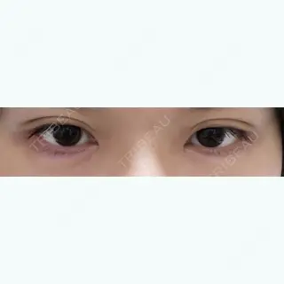 48日目の経過画像（1枚目）