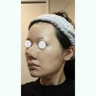 1日目の経過画像（2枚目）