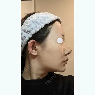 1日目の経過画像（3枚目）