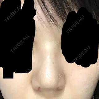 10日目の経過画像（1枚目）