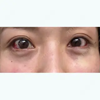 0日目の経過画像（1枚目）