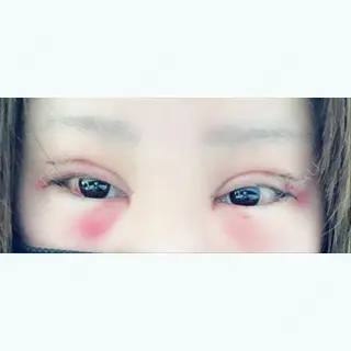 2日目の経過画像（1枚目）