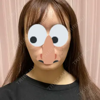 4日目の経過画像（1枚目）