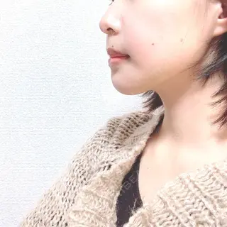 12日目の経過画像（3枚目）