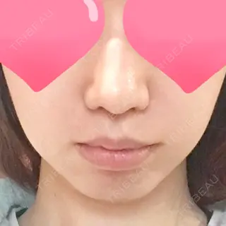 21日目の経過画像（1枚目）
