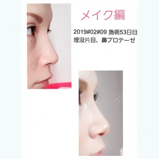 53日目の経過画像（2枚目）