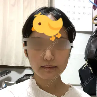 7日目の経過画像（1枚目）