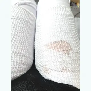 0日目の経過画像（2枚目）