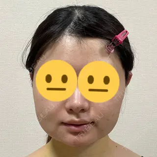 3日目の経過画像（3枚目）