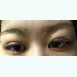 22日目の経過画像（1枚目）