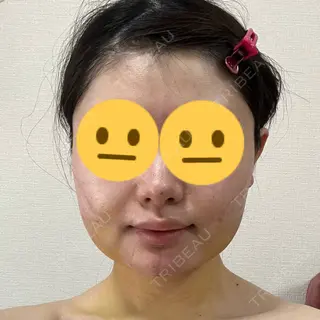 7日目の経過画像（1枚目）