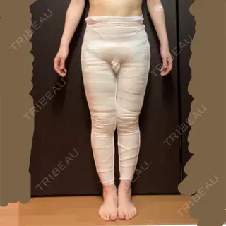 0日目の経過画像（3枚目）