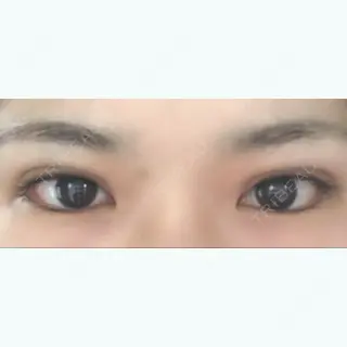 19日目の経過画像（1枚目）