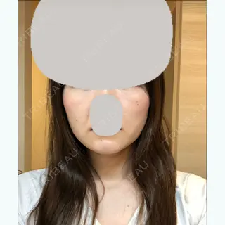 98日目の経過画像（1枚目）