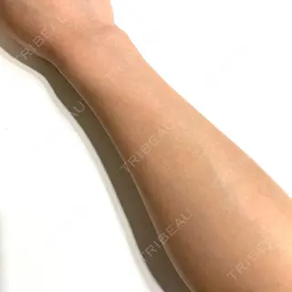 21日目の経過画像（1枚目）
