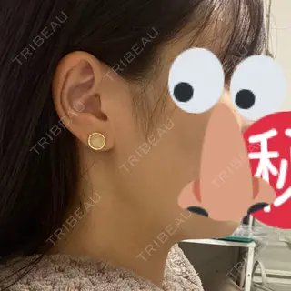 21日目の経過画像（3枚目）