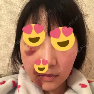 10日目の経過画像（1枚目）
