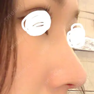 8日目の経過画像（2枚目）
