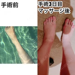 3日目の経過画像（1枚目）