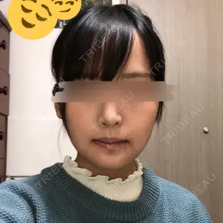 9日目の経過画像（1枚目）