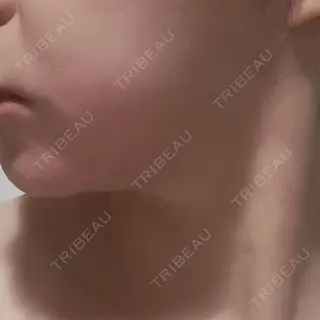 8日目の経過画像（2枚目）