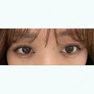 7日目の経過画像（1枚目）