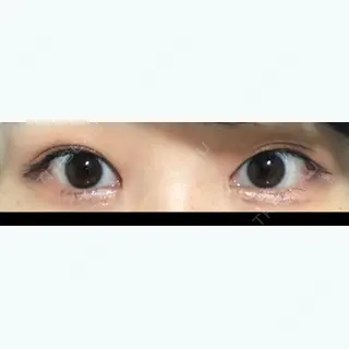 16日目の経過画像（1枚目）