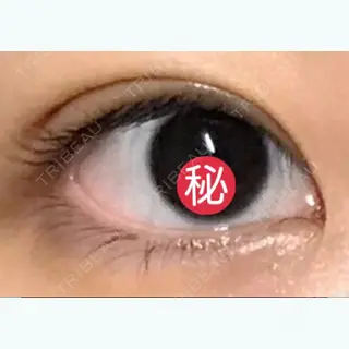 10日目の経過画像（1枚目）